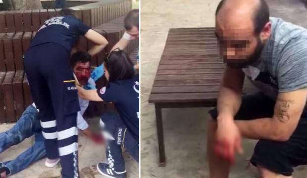 Antalya'da feci olay! Arkadaşını bu hale getirdi