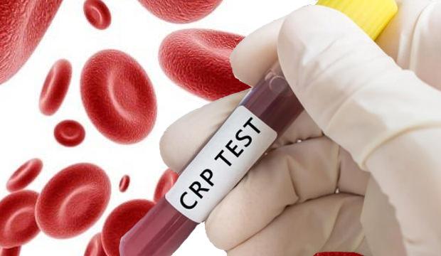 CRP değeri nedir? CRP yüksekliği ne anlama geliyor?