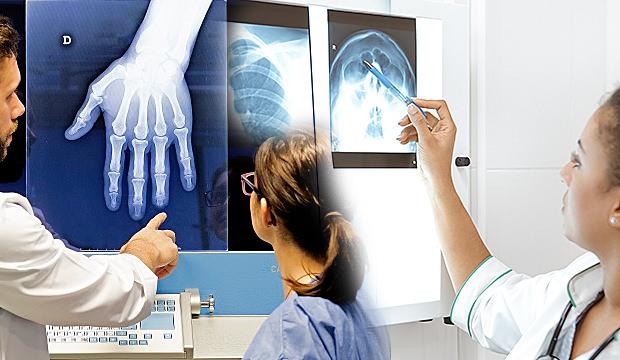 Kireçlenme neden olur ve nasıl geçer: Kireçlenme bitkisel tedavisi nasıldır?