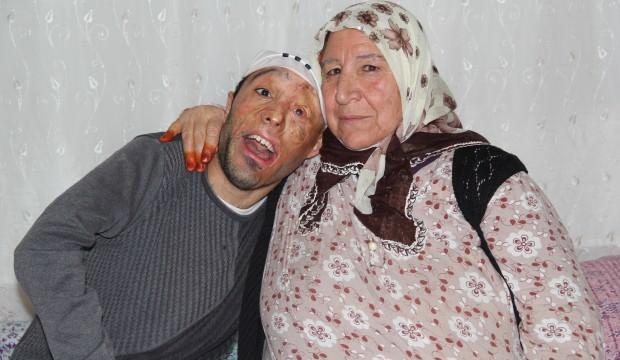 Mehmet'in yürek yakan dramı!