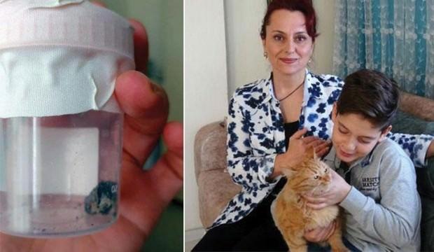 19 yıl bu kurşunla yaşadı! 'Ne erkek olunur ne de...'