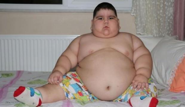 4 yaşında 70 kiloya ulaşan Yağız, yardım bekliyor