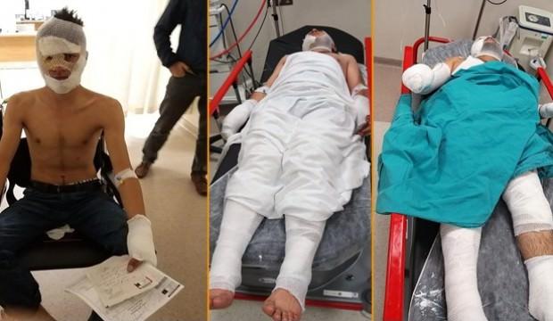 Ev yakmak isteyen arkadaşlar dehşeti yaşadı