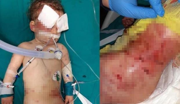 Anne 'köpek saldırısı' dedi doktor inanmayınca...