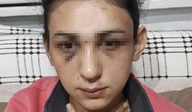 Eski eşinden şiddet gören kadın, sosyal medyadan yardım istedi