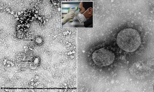 Virüs mikroskobik ortamda ilk kez görüntülenmişti...