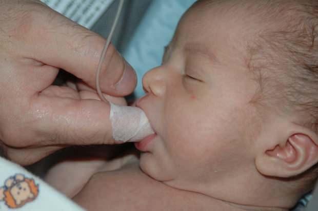Finger Feeding (Parmakla beslenme) yöntemi nedir? Şırınga ile bebek nasıl beslenir?