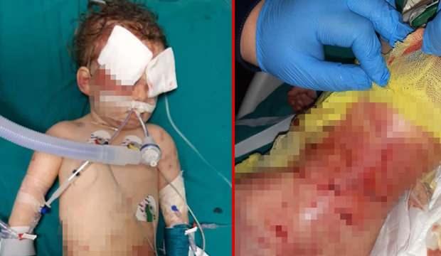 2 yaşındaki bebek dehşeti yaşadı! 'Köpek çocuğumun kafasını ağzına aldı'