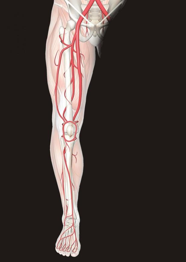 bacaklardaki sinirlerdeki rahatsızlık bacak ağrısına neden olur
