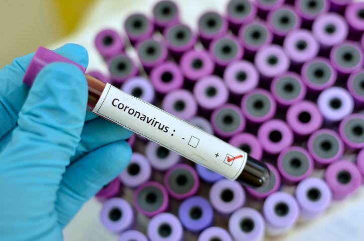 Son dakika haberi: Bilim kurulu üyesi duyurdu: Bazı HIV ve bazı sıtma ilaçları koroanvirüste bir miktar etkili oluyor.