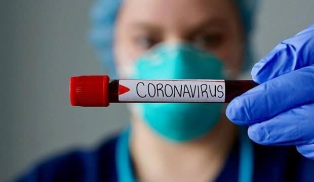 Corona Virüs testi yapan hastaneler hangileri?