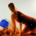 Milyonluk tablo değil! Çinli kadın X-Ray'de