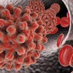 Hepatit B nedir? Bulaşıcı mıdır?