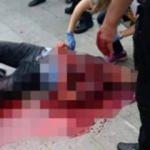 Sokak ortasında boğazını kesip sırtından bıçakladı