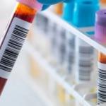10 yıl içindeki ölümleri tahmin eden test geliştirildi