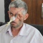 Akılalmaz olay! Dişini çektirdi, bu hale geldi