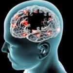 Alzheimer hastalığı ilk belirtilerden 20 yıl önce başlıyor