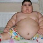 4 yaşında 70 kiloya ulaştı! Çaresiz aile yardım bekliyor