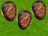 Saç ektiren Rooney alay konusu
